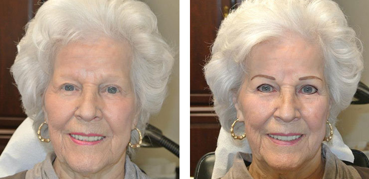 Before and After - Eyebrows & Eyes