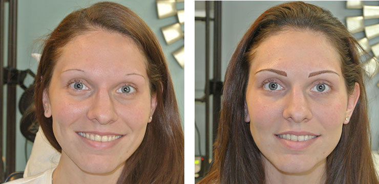 Before and After - Eyebrow Microblading