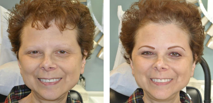 Before and After - Eyebrows & Eyes