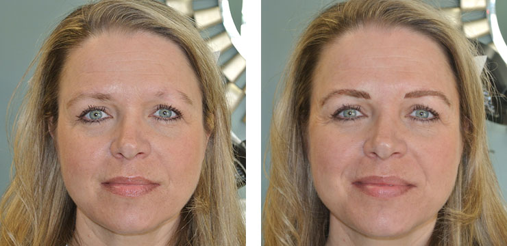 Before and After - Eyebrow Microblading