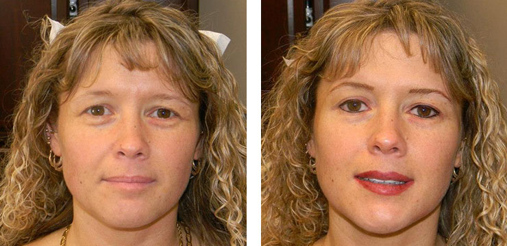 Before and After - Eyebrows, Eyes & Lips