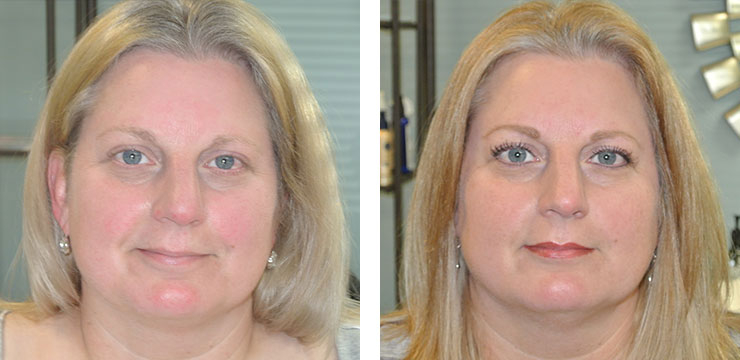 Before and After Photo - Permanent Cosmetics of Maryland